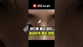 여드름 흉터 없이 깔끔하게 짜는 법 #Shorts