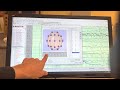 natus xltek programming a bipolar montage