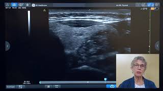 Introducing Simple Screen on Venue™ Family POCUS