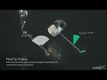 endoscopic transforaminal approach for a herniated disc