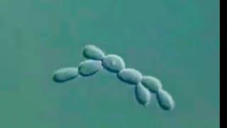 Budding of Yeast cells under microscope - #Microbiology
