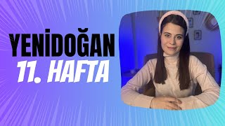 Yenidoğan 11. Hafta | 11 Haftalık Bebek Gelişimi