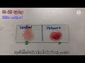 การตรวจหมู่เลือด abo และหมู่เลือด rh abo blood grouping and rh d typing