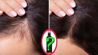 চুল পড়া বন্ধ হবেই💯 Best Anti Hair Fall Hair Growth Oil🚀 চুল পড়া বন্ধ করা ও নতুন চুল গজানোর সেরা তেল