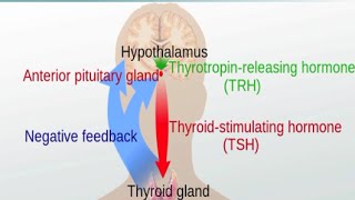 Graves' Disease and Hashimoto's Thyroiditis