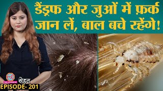 Lice यानी जुओं से हमेशा के लिए छुटकारा पाने के आसान उपाय | Hair | Haircare | Sehat ep 201