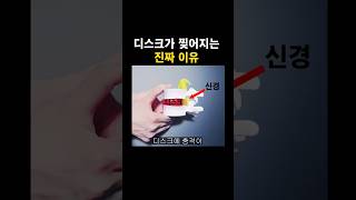 허리디스크가 찢어지는 진짜 원인 #허리디스크  #허리통증  #디스크