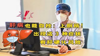 肝病也能自检：上厕所！出现这 3 种症状，有肝硬化风险