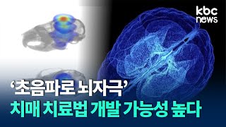 '초음파로 뇌자극' 치매 치료법 개발 가능성 높아져 / kbc뉴스