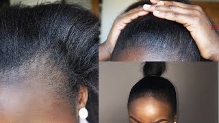 HOW TO THICKEN AND COVER UP BALD EDGES | HIGH BUN TUTORIAL