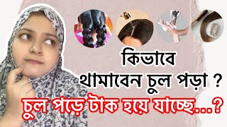 চুল পড়ে টাক হয়ে যাচ্ছে…?? কিভাবে থামাবেন চুল পড়া ??