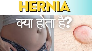 Hernia kya hota hai | causes of hernia | हर्निया क्या है | हर्निया का कारण