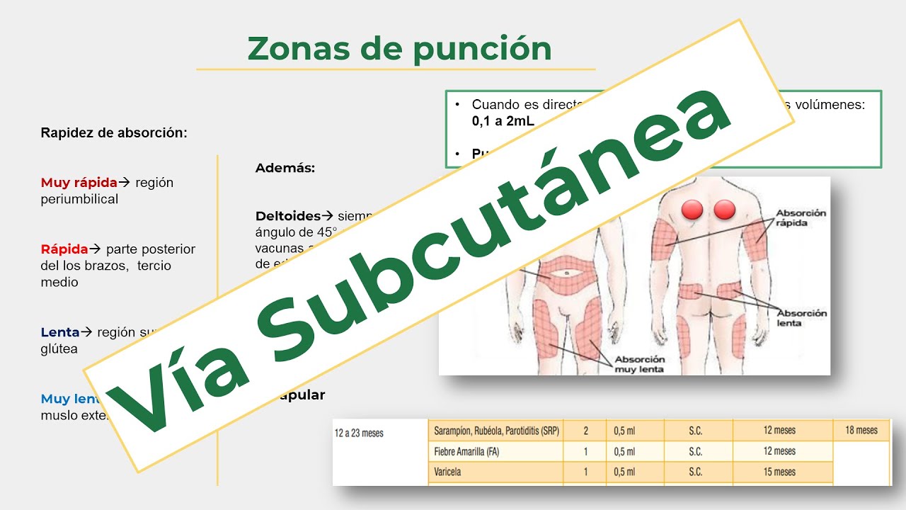 Vía De Administración Subcutánea. Indicaciones, Contraindicaciones ...