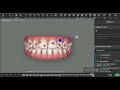 3D Controls Quick Tip: How to Reduce Treatment Time