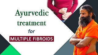 Ayurvedic Treatment for Multiple Fibroids | Swami Ramdev