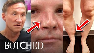 7 Most MEMORABLE "Botched" Moments of 2021 | Botched | E!