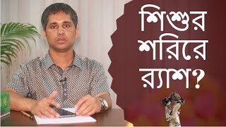 শিশুর শরিরে র‌্যাশ উঠলে কি করবেন | Child Specialist Dr. Abu Talha |  Kids and Mom