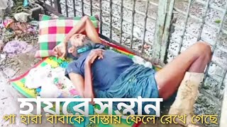 কে শুনে এই দুই পা হারা অসহায় ভিক্ষুক এর কথা। টানা ২ দিন না খেয়ে একি স্থানে শুয়ে আছে। #অসহায়