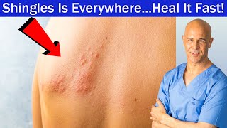 Shingles Is Everywhere...Heal It Fast! Dr. Mandell