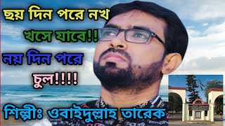 ছয় দিন পরে নোখ খসে যাবে!! নয় দিন পরে চুল!! কবর জায়গা ভালো নয়- শিল্পী ওবাইদুল্লাহ তারেক #islamic