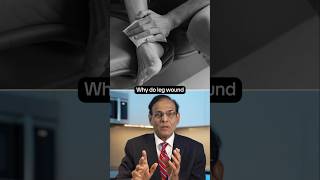 Why Leg Wounds Heal Slowly | Poor Circulation, Diabetes & Slow Healing Explained