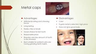 Tooth caps and crowns#JLMUSH