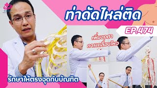 ดัดไหล่ติดด้วยตัวเอง | รักษาให้ตรงจุดกับบัณฑิต EP.474