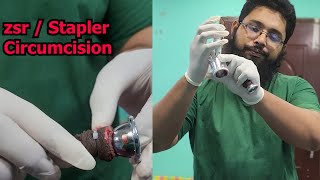 সরাসরি Stapler Circumcision দেখুন || ZSR Circumcision In Bangladesh