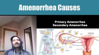 Amenorrhea ( Absence of Menstuaration Periods) :Types and Causes