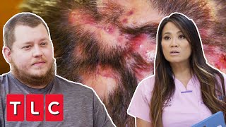 Dr Lee Helps Father That’s Been Suffering With Misdiagnosis For 3 Years | Dr Pimple Popper Pop Up