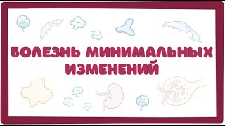 Болезнь Минимальных Изменений (нефротический синдром) лекция