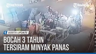 BOCAH 3 TAHUN DI KOTAGEDE TERSIRAM MINYAK PANAS SAAT BELI GORENGAN