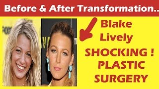 Blake Lively Plastic Surgery Before and After Full HD
