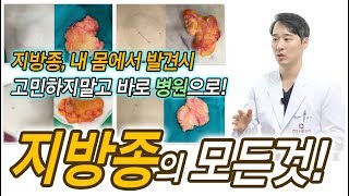 몸에서 지방종 발견 시 무조건 병원가세요! [성형 알려주는 남자 이용석]