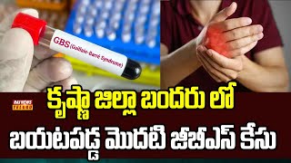 కృష్ణా జిల్లా బందరు లో బయటపడ్డ మొదటి జీబీఎస్ కేసు | First GBS Case Reported in Bandar | Raj News