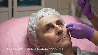 Коррекция мимических морщин с помощью препарата ксеомин