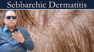 Sebbarehic Dermatitis / Dr.C.K.Nandagopalan