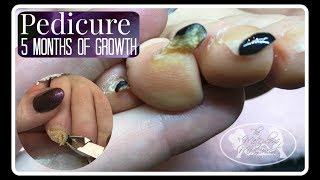 Pedicure Tutorial: How to Cut Long Thick Deformed Toenails and Gel Polish