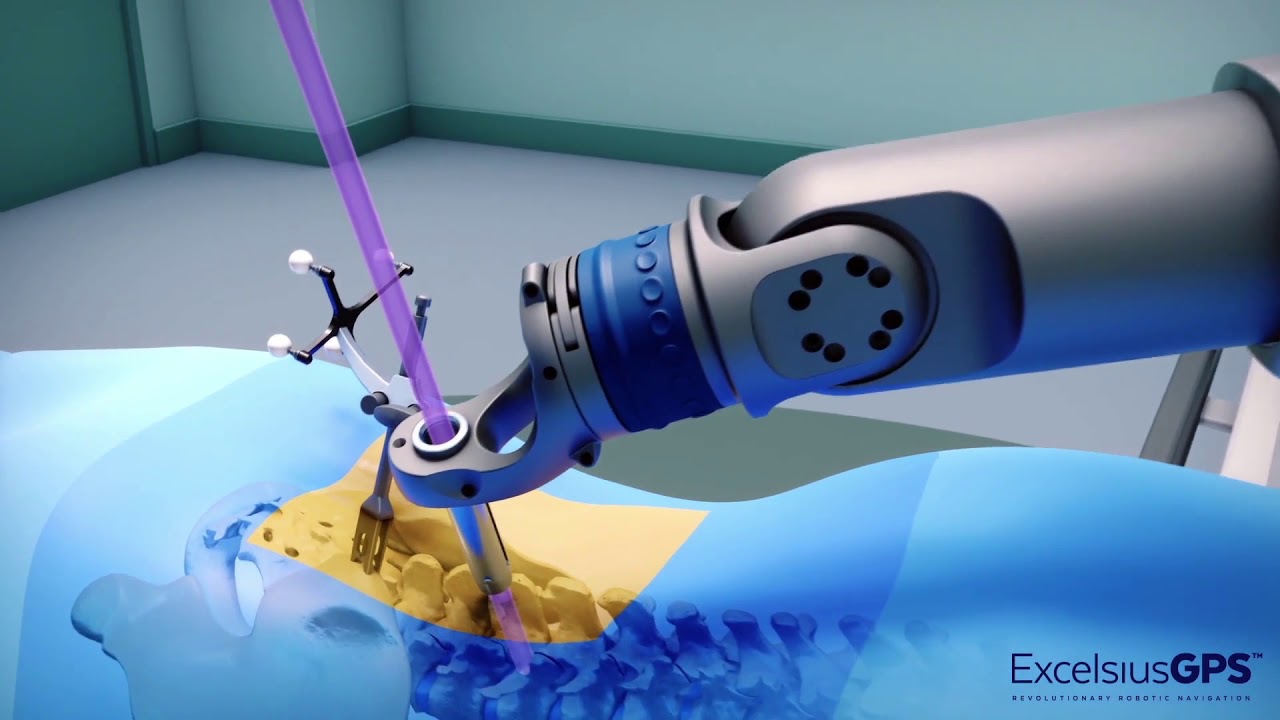 Robotic Spine Surgery Youtube