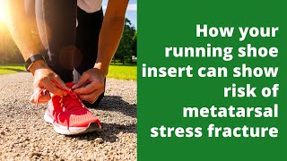 How your running shoe insert can show risk of metatarsal stress fracture