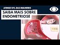 Endometriose atinge 10% das mulheres no Brasil