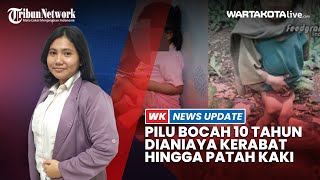 Pilu Bocah 10 Tahun di Nias Dianiaya Tante, Disiksa Ayah hingga Kaki Patah