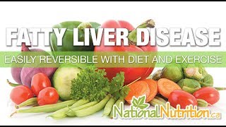 Natural Health Reviews - NASH - Alcoholic or Non-Alcoholic Fatty Liver Disease | National Nutrition