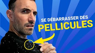 Comment se débarrasser efficacement des Pellicules !