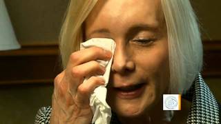 Eyelid surgery leaves woman unable to blink