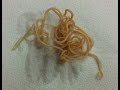 Roundworms in Dogs: Toxocara canis & Toxascaris leonina Roundworms in Dogs: Toxocara canis & Toxascaris leonina