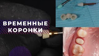 ВРЕМЕННАЯ ПРОВИЗОРНАЯ КОРОНКА полный протокол