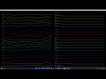 Real Time EEG Plotting using PyQtgraph