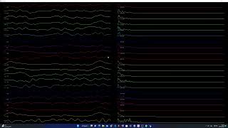 Real Time EEG Plotting using PyQtgraph