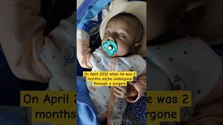 Major surgery to just 2 months baby🥺Right inguinal hernia | Our struggle story #shorts #surgery